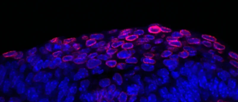 Developing mouse incisor bud
