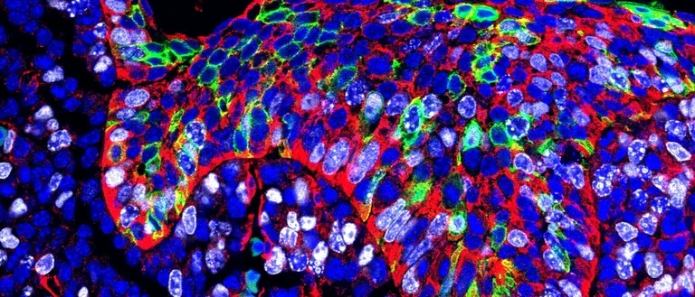 Developing tooth germ