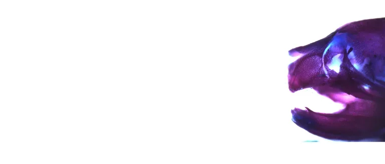 alizarin red staining of mouse embryo head 2