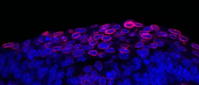 Developing mouse incisor bud