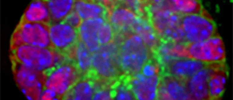 Dental epithelial organoid