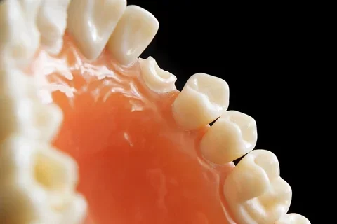 dental arch model with prepared tooth