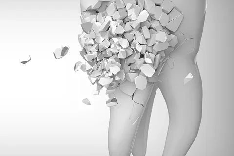 tooth breaking apart illustration graphic