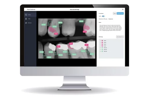 A computer monitor showing the A user's view of the Pearl Calibrate system.