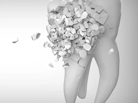 tooth breaking apart illustration graphic