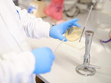 hands with blue gloves working with a petri dish