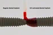 Two dental implants side-by-side