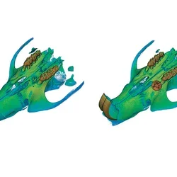 3D images of a rat jawbone with peri-implantitis and a failed titanium mini implant screw (left) and with a successful implant that used the UCLA adhesive hydrogel treatment (right).