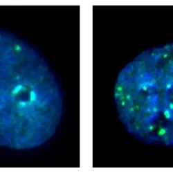 Immunofluorescence images of cancer cells with and without KDM4A
