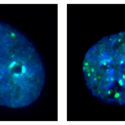 Immunofluorescence images of cancer cells with and without KDM4A