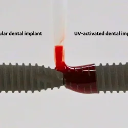 Two dental implants side-by-side